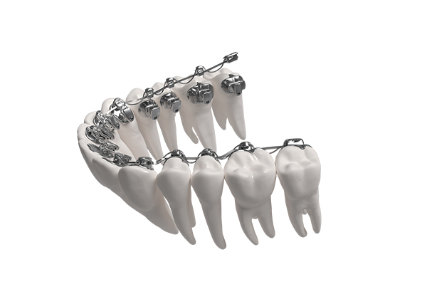 Product-1