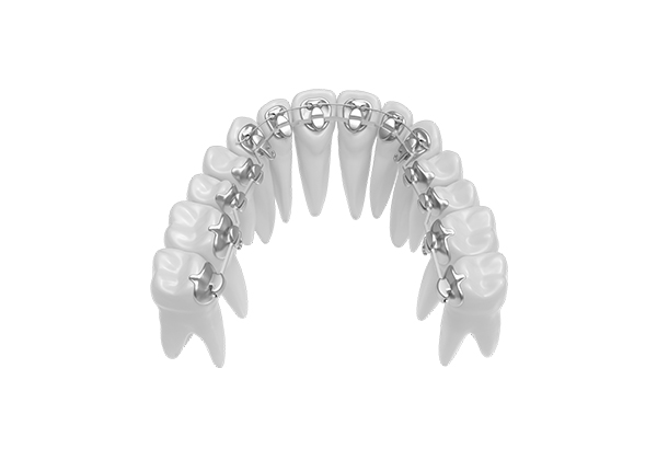 Product-1