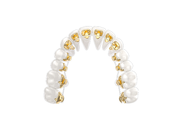 Product-1