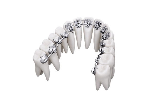 Product-1